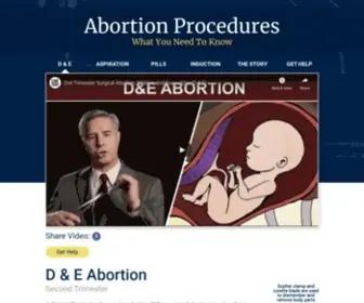 Abortionprocedures.com(Abortion Procedures D&E Abortion Procedure) Screenshot