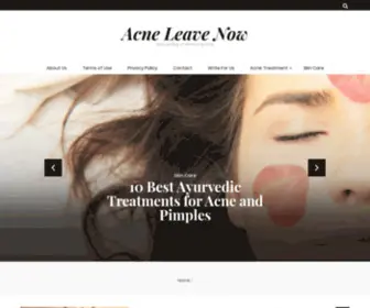 Acneleavenow.com(Acne Leave Now) Screenshot