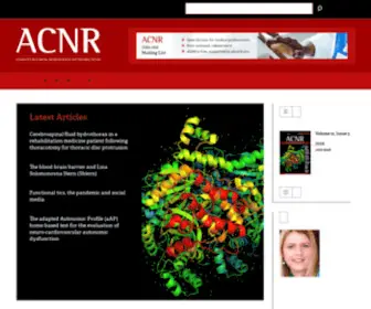 ACNR.co.uk(Open Access Neurology Journal) Screenshot