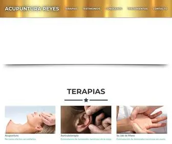 Acupunturareyes.com(Las Moxas y la Moxibustión) Screenshot