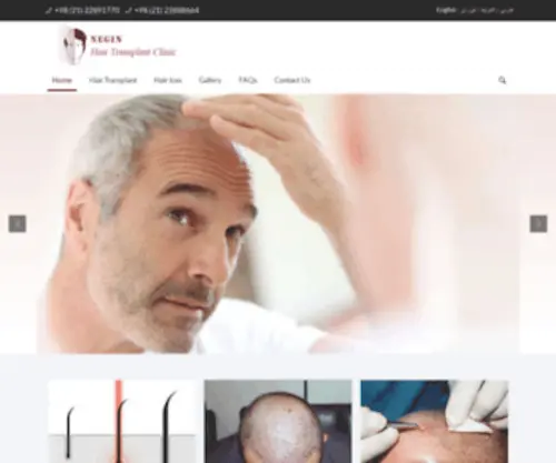 AHHTC.com(Ahmad Hosseinpour Hair Transplant Clinic) Screenshot