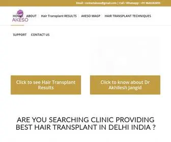 Akesohairtransplant.com(BEST HAIR TRANSPLANT IN INDIA) Screenshot