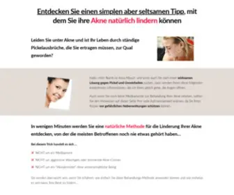 Akneloswerden.com(Nie wieder Pickel) Screenshot