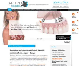 Allon4.com.au(All On 4 Dental Implants) Screenshot