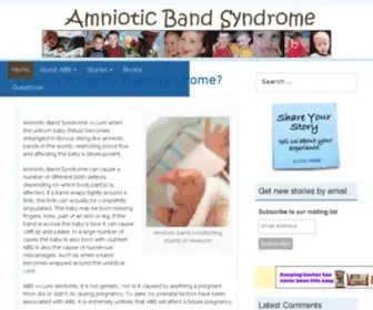 Amnioticbandsyndrome.com(ABS can cause a number of different birth anomalies) Screenshot