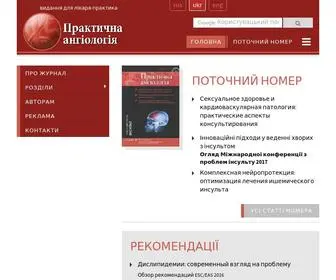 Angiology.com.ua("Практична) Screenshot
