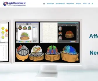 Appliedneuroscience.com(Biofeedback) Screenshot