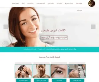 Ariansima.com(کاشت مو) Screenshot