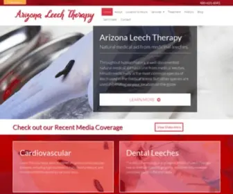 Arizonaleechtherapy.com(Arizona Leech Therapy) Screenshot