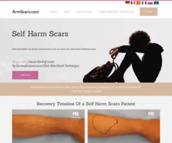 Armscars.com(Self Harm Scars Removal Treatment) Screenshot