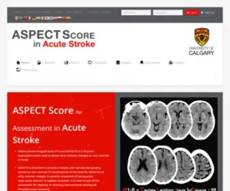 Aspectsinstroke.com(ASPECTS Score in Acute Stroke Website) Screenshot