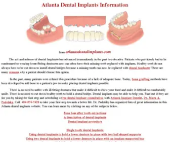 Atlantadentalimplants.com(Dental implants) Screenshot