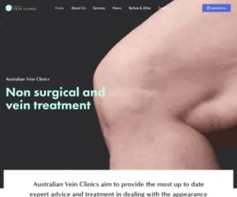 Australianveinclinics.com.au(Australian Vein Clinics) Screenshot