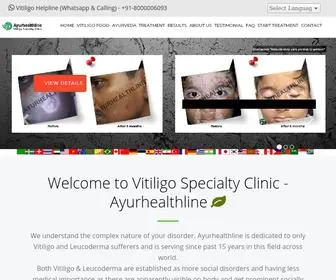 Ayurhealthline.com(Ayurvedic Vitiligo) Screenshot