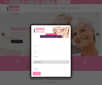 Bawadentalclinic.com(Best Dentist in Chandigarh) Screenshot