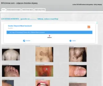 Bolimnie.com(Zdjęcia choroba objawy) Screenshot