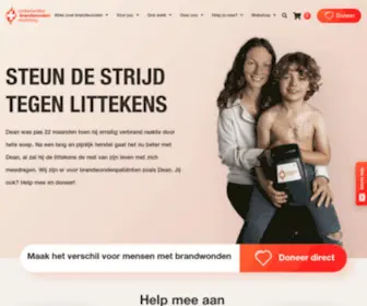 Brandwondenstichting.nl(Nederlandse Brandwonden Stichting) Screenshot