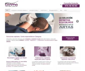 Canma.es(Microinjerto capilar y Tratamientos capilares en Zaragoza) Screenshot