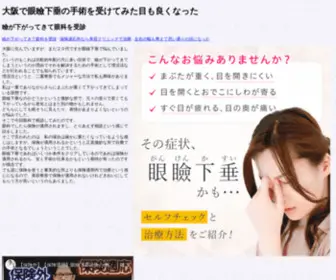 Centerforteachersuccess.org(大阪で眼瞼下垂の手術を受けてみた目も良くなった) Screenshot