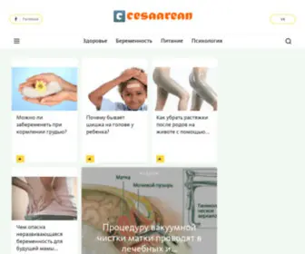 Cesaarean.ru(Беременность) Screenshot