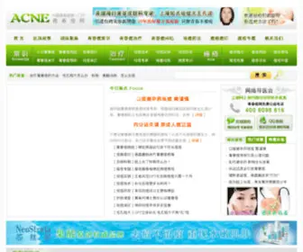 Chinaacne.com(百科知识网) Screenshot