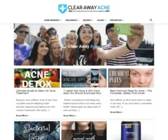 Clearawayacne.com(Best Acne Treatments & Remedies Guides) Screenshot