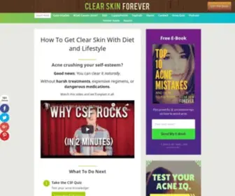 Clearskinforever.net(How To Get Rid of Acne (With Your Diet)) Screenshot