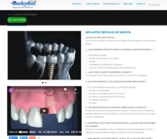 Clinicadentalblankydent.com(Implantes Dentales en Bogotá al mejor precio y calidad) Screenshot