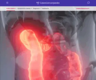 Coloncancerpedia.com(Colon Cancer) Screenshot