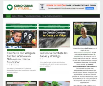 Comocurarelvitiligo.info(▷ Como Curar El Vitiligo (Rápido y para Siempre en 2021) Screenshot