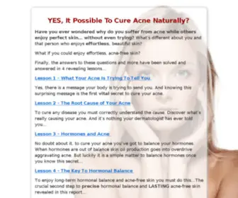Curingacnenaturally.com(已通过浏览器安全认证) Screenshot