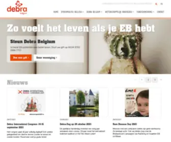 Debra-Belgium.org(Debra Belgium vzw) Screenshot