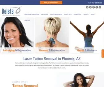 Deleteitnow.com(Tattoo &amp; Hair Removal in Phoenix) Screenshot