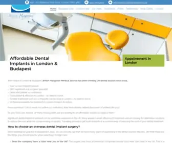 Dentalimplanthungary.co.uk(Dental Implants in London) Screenshot