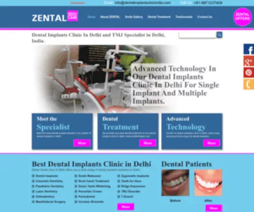 Dentalimplantsclinicindia.com(Dental Implants Clinic In Delhi) Screenshot