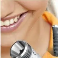 Dentalimplantsdominicanrepublic.com Logo