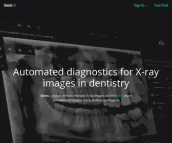 Denti.ai(AI for Dental X) Screenshot