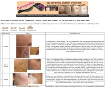 Dermaroller-Malaysia.com(Buy derma roller or dermaroller for sale in Malaysia) Screenshot