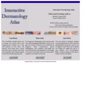 Dermatlas.net(Interactive Dermatology Atlas) Screenshot