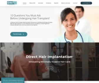 Dhiglobal.com(DHI Direct Hair Implantation) Screenshot