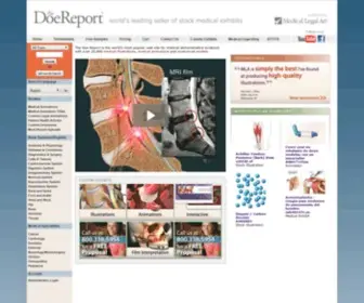 Doereport.com(The Doe Report) Screenshot