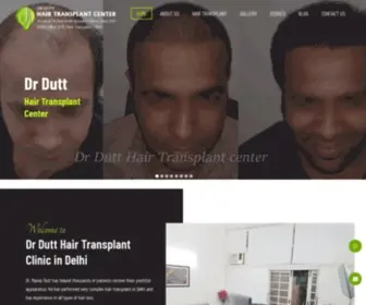 Drdutthairtransplant.com(Dr Manas Dutt) Screenshot