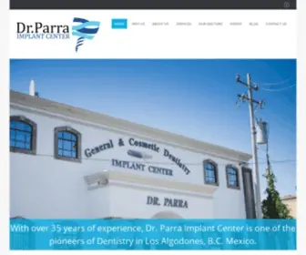 Drparraimplantcenter.com(Parra Implant Center) Screenshot
