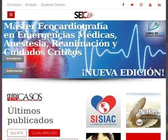 Ecocardio.com(Imagen cardíaca) Screenshot