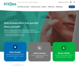 Eczema.org(National Eczema Society) Screenshot