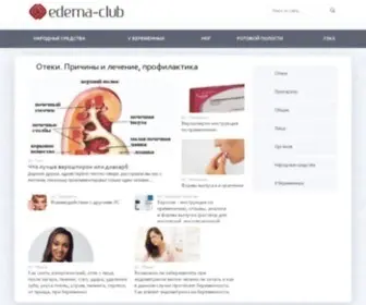 Edema-Club.ru(Отеки) Screenshot