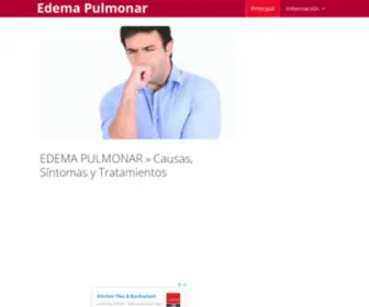 Edemapulmonar.com(EDEMA PULMONAR) Screenshot