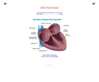 Ekgstripsearch.com(EkG STRIP SEARCH) Screenshot