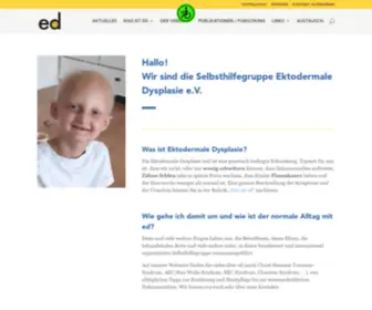 Ektodermale-DYSplasie.de(Selbsthilfegruppe Ektodermle Dysplasie e.V) Screenshot