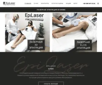 Epilaser.com.ua(Безболезненная ❤️ ELOS и 3D лазерная эпиляция в Киеве) Screenshot